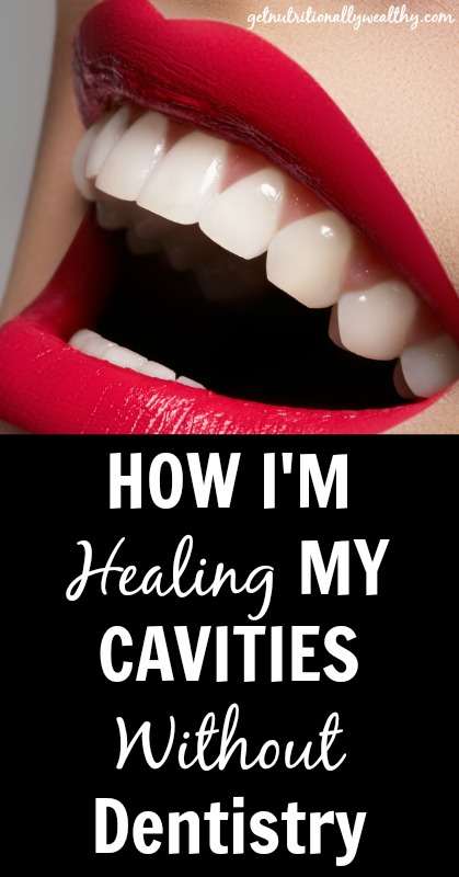 How I'm healing my cavities without dentistry | nutritionallywealthy.com | Butternutrition.com