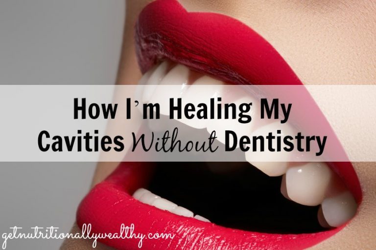 How I’m Healing My Cavities Without Dentistry - NW