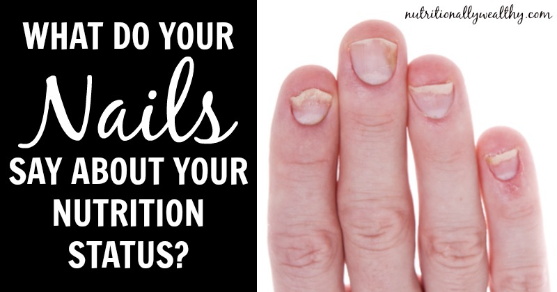 What are your fingernails trying to tell you about your nutrition status? Nutritionally Wealthy